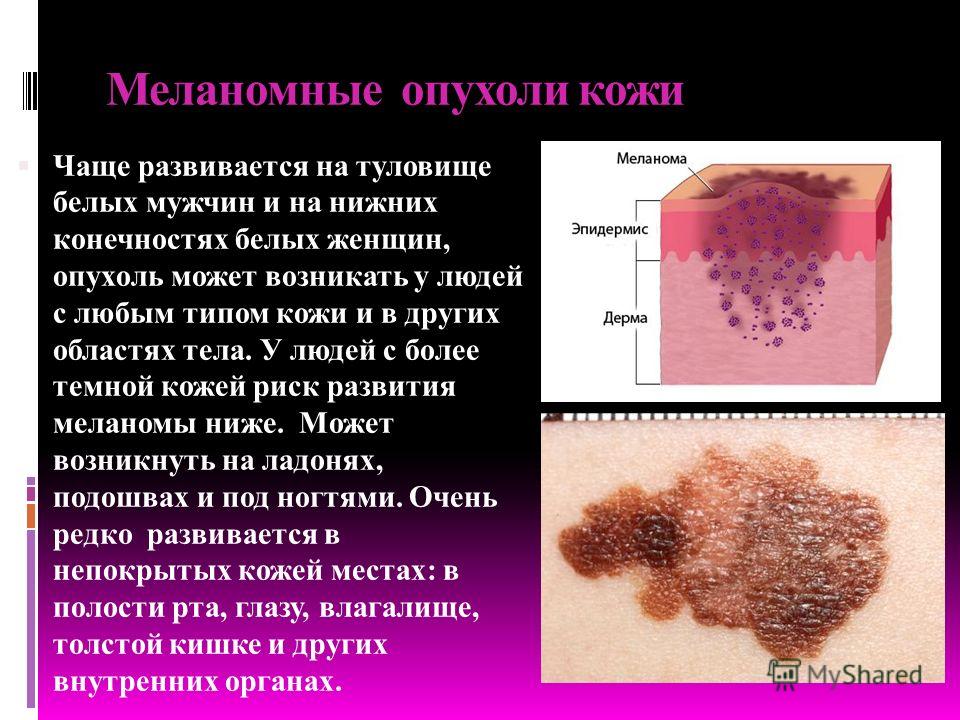 Лазерное лечение пигментных пятен на лице / Лазерный Курсовая работа: Анализ финансовой деятельности предприятия