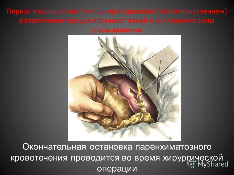 Как остановить в домашних условия внутреннее кровотечение Как остановить в домашних условия внутреннее кровотечение