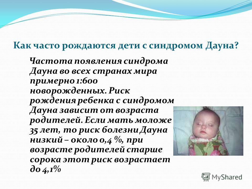 разрез глаз у детей с синдромом дауна фото онлайн разрез глаз у детей с синдромом дауна фото