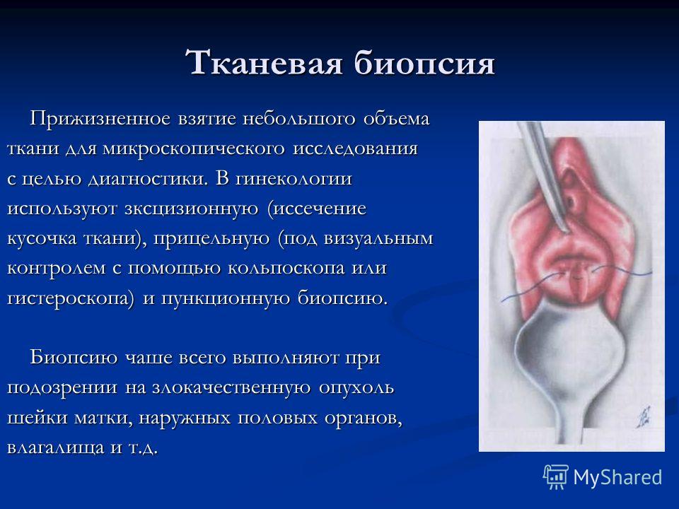 Диагноз в гинекологии 76