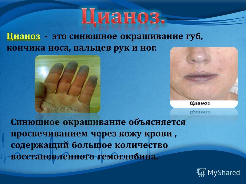 Съемные зубные протезы на присосках: виды, установка и уход Списки для обязательного чтения по литературе по программе