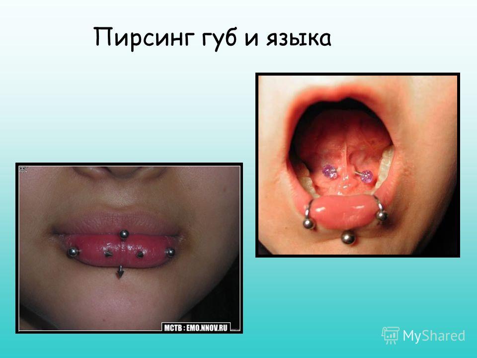 Пирсинги для языка и губ Пирсинги для языка и губ