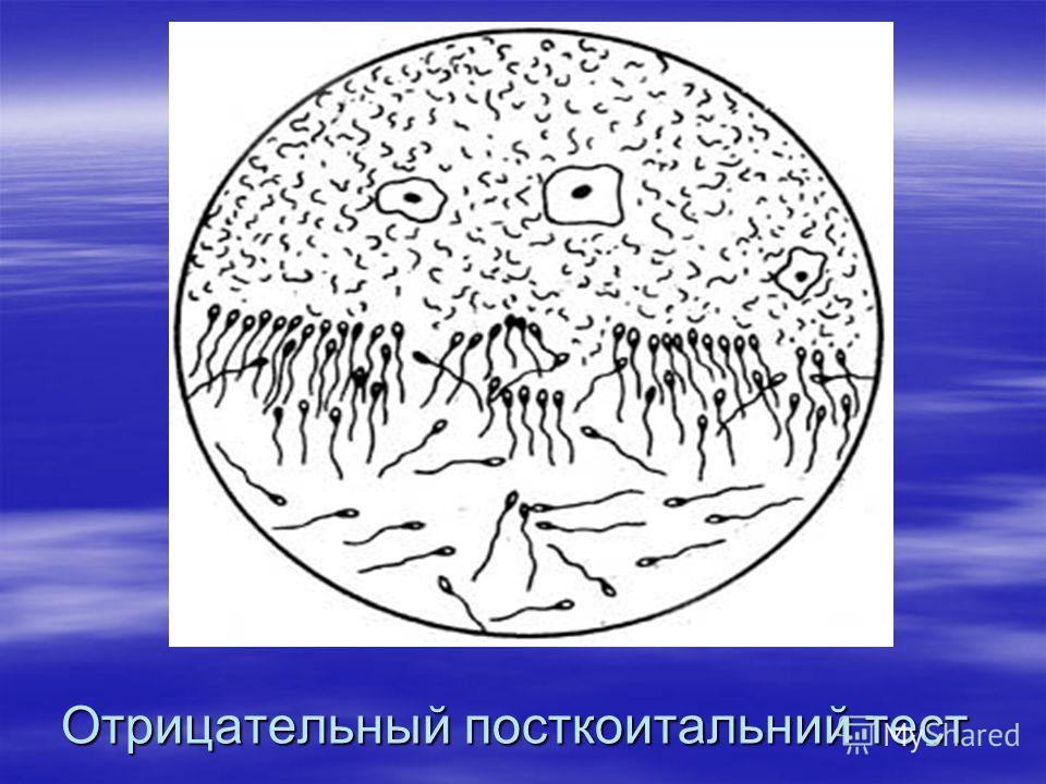 Пластика маточной трубы лапароскопия Пластика маточной трубы лапароскопия