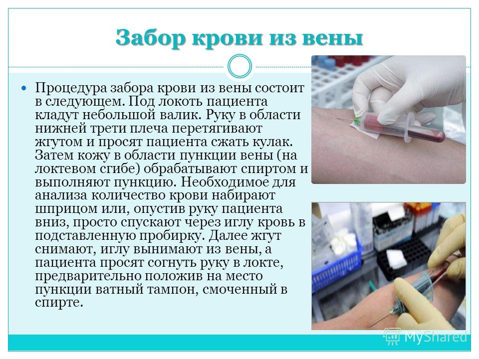 Льняное масло при варикозе