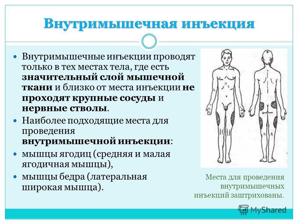 Мазь и таблетки от варикоза