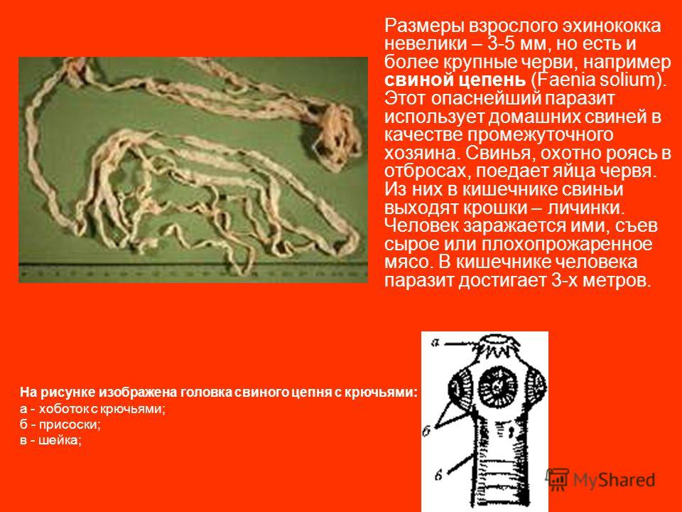 паразиты в кишечнике человека фото паразиты в кишечнике человека фото
