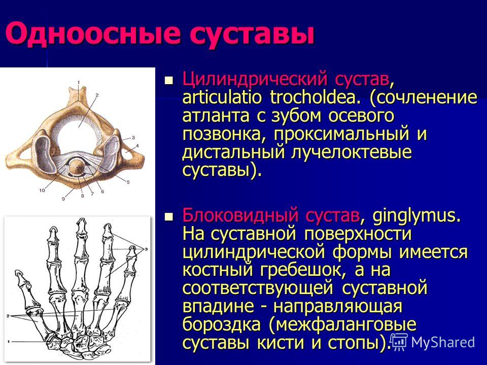 Одноосные суставы по форме Одноосные суставы по форме