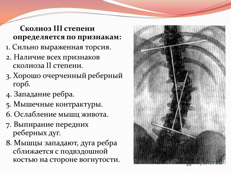 Комплекс упражнений для исправления осанки у детей в картинках