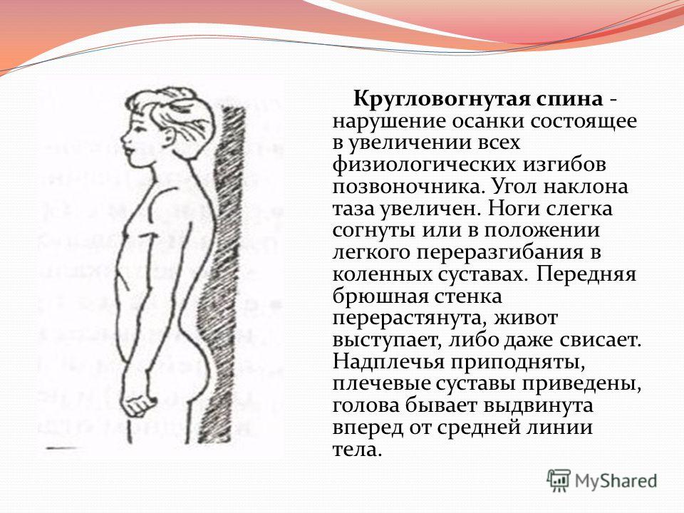 Степень сколиоза градусов