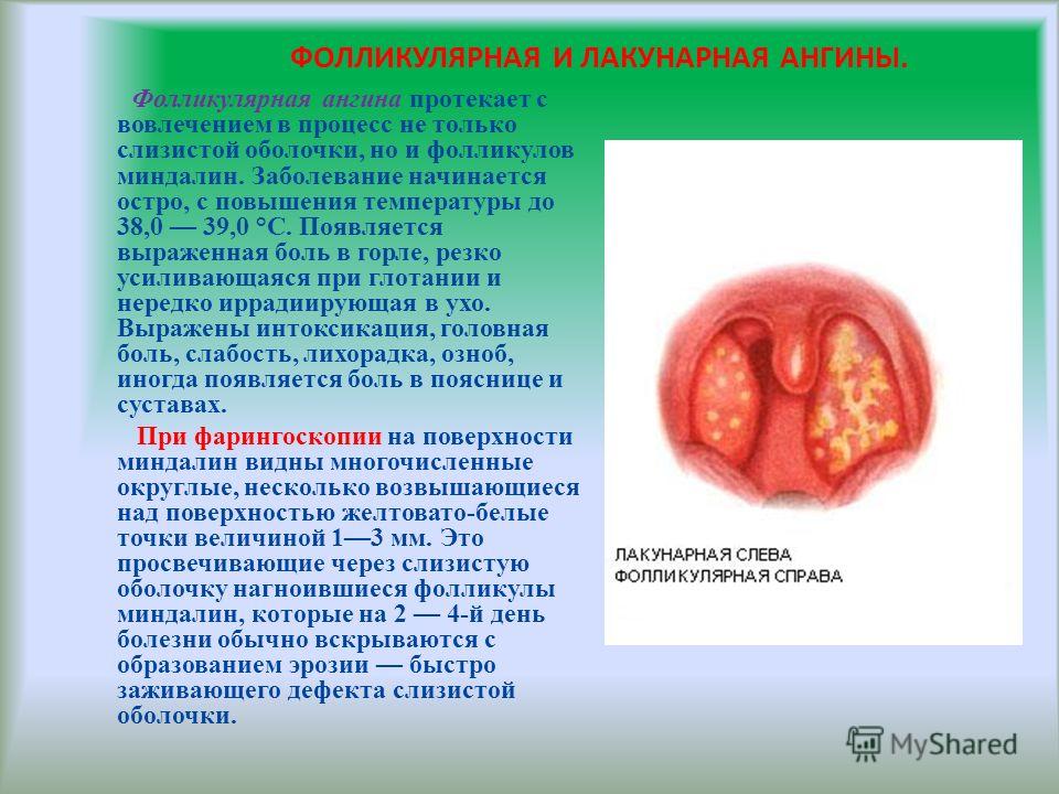 Вязание пуловеров, вязание свитеров Вязание, вязание Анекдоты про врачей и пациентов