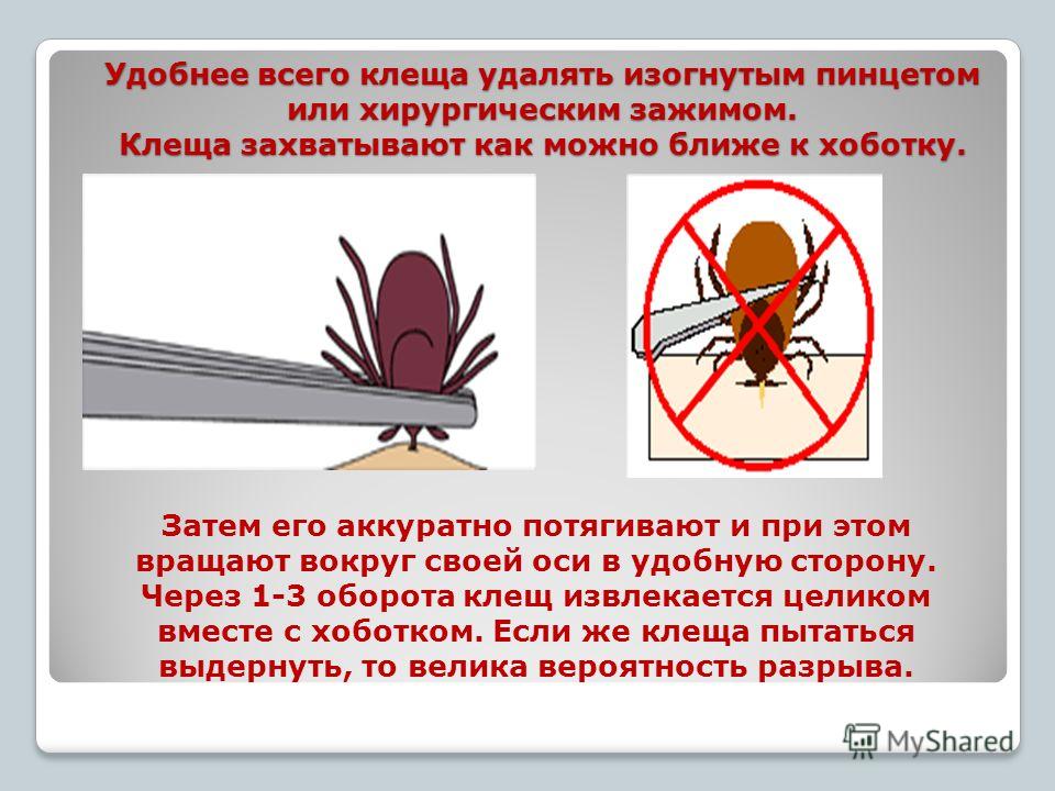 Вынуть клеща в домашних условиях Вынуть клеща в домашних условиях