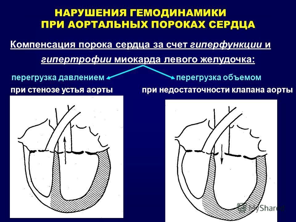 Приобретенный псориаз причины 4