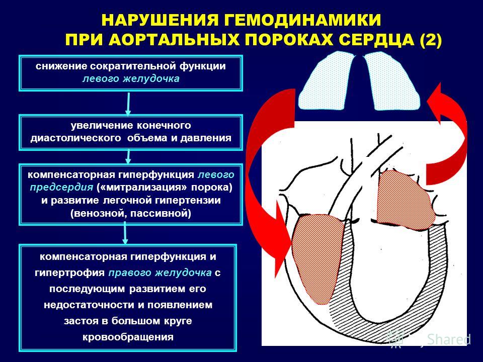 Схема лечения нарушения кровообращения Схема лечения нарушения кровообращения