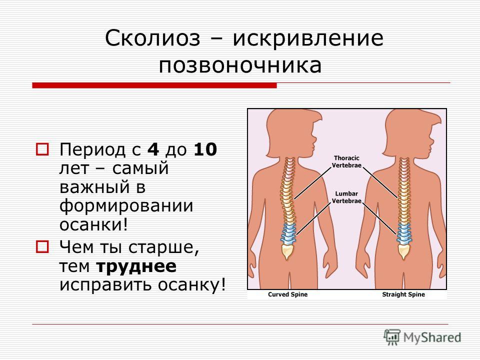 Проект на тему сколиоз 9 класс