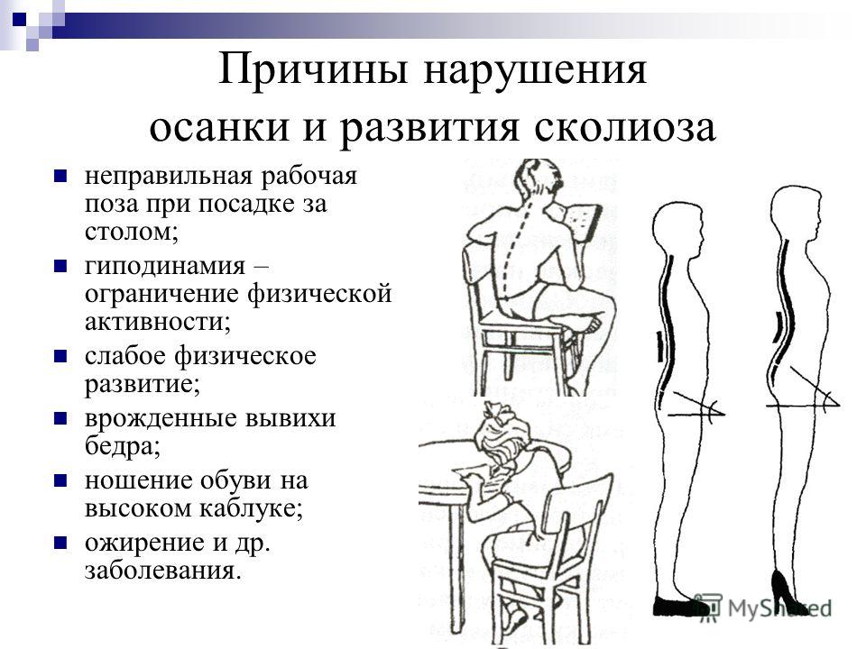 Реферат: Осанка. Типы нарушения осанки у детей и подростков. Профилактика нарушений осанки у детей и подр