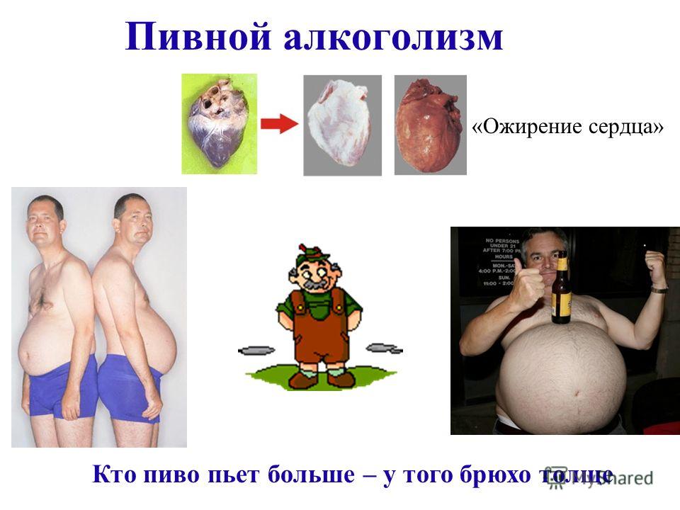 Принудительное лечение алкоголизма по закону