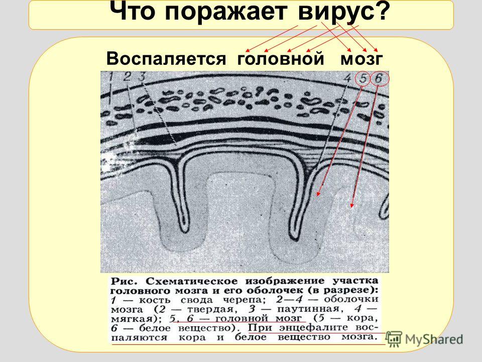 Клещ сидит в одежде Клещ сидит в одежде