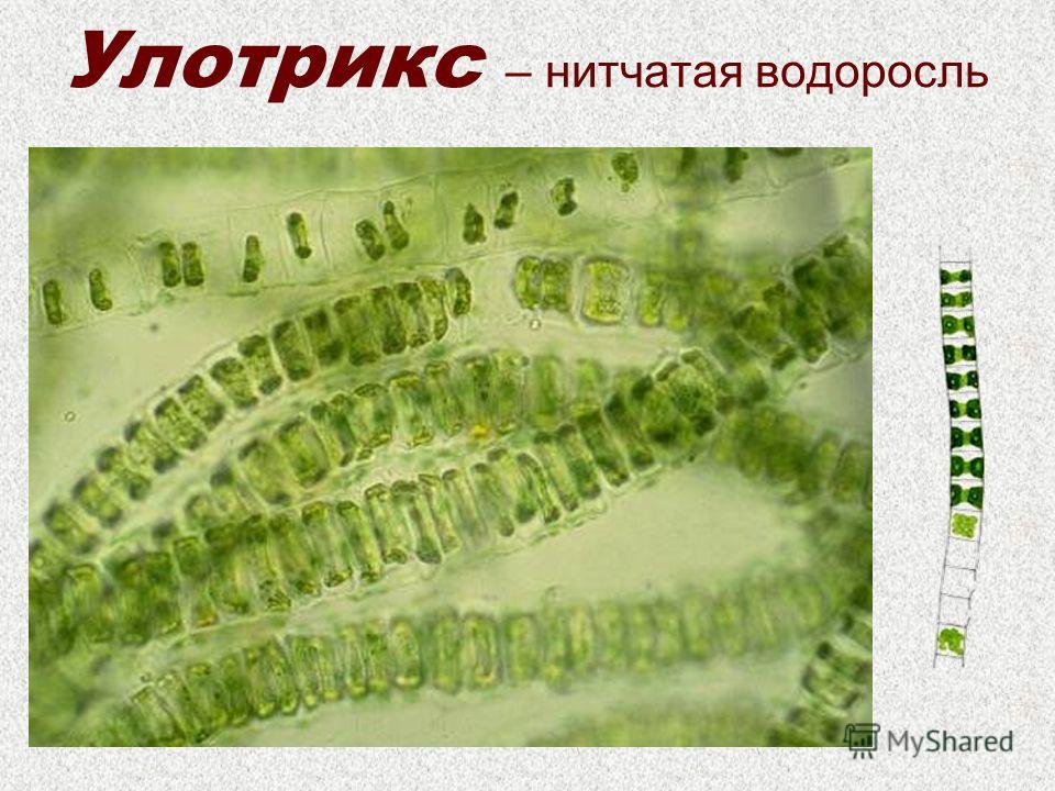 Улотрикс – нитчатая водоросль