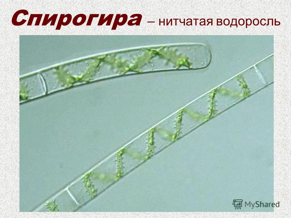 Спирогира – нитчатая водоросль
