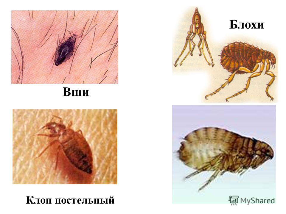чем отличается блоха от вши фото онлайн