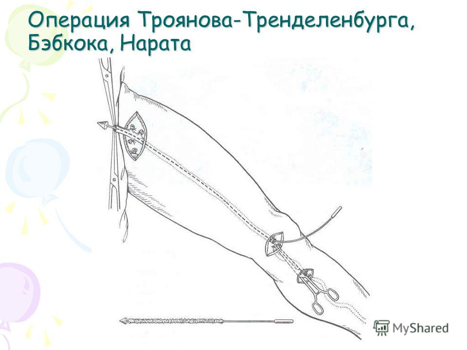 операция троянова последствия операция троянова последствия