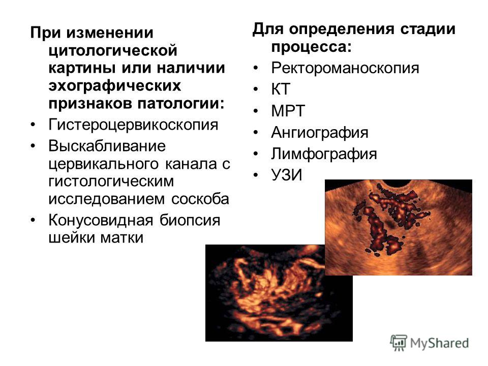 Результаты гистология в гинекологии