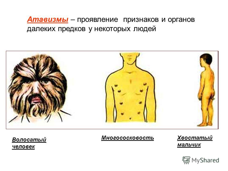 Почему атавизмы у людей проявляются лишь в редких случаях Почему атавизмы у людей проявляются лишь в редких случаях
