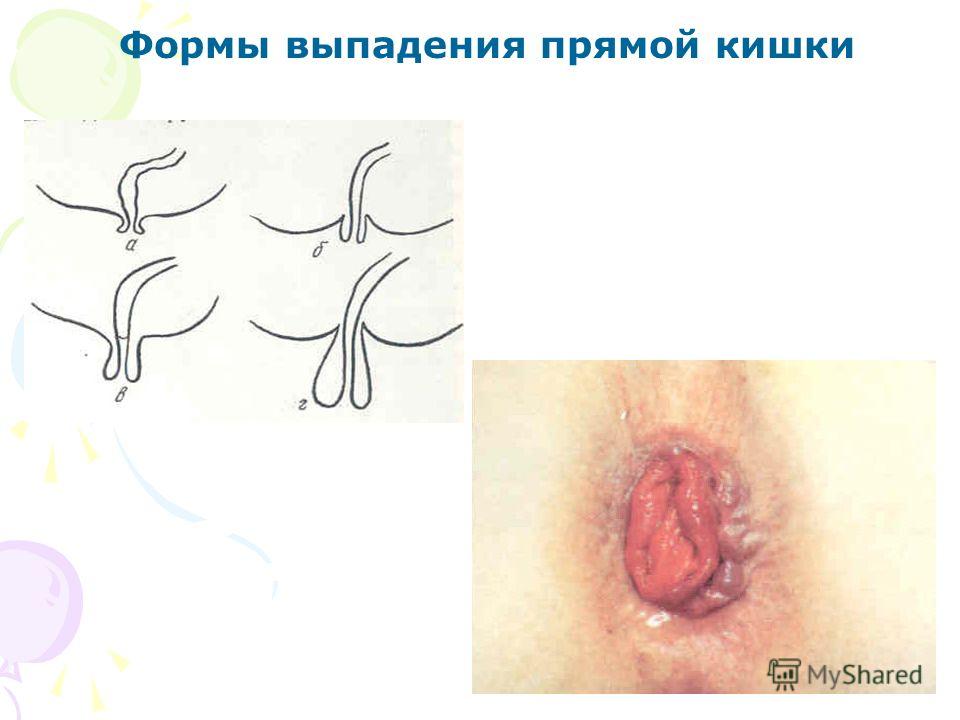 сыпь на лице у детей фото с пояснениями