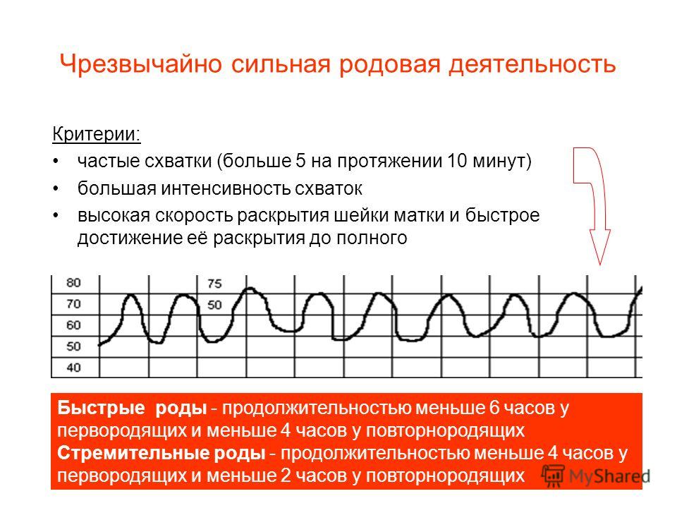 Почему слабая родовая деятельность Почему слабая родовая деятельность