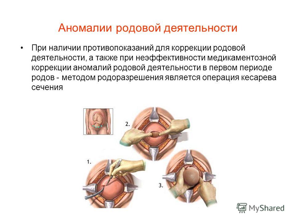 Почему слабая родовая деятельность Почему слабая родовая деятельность