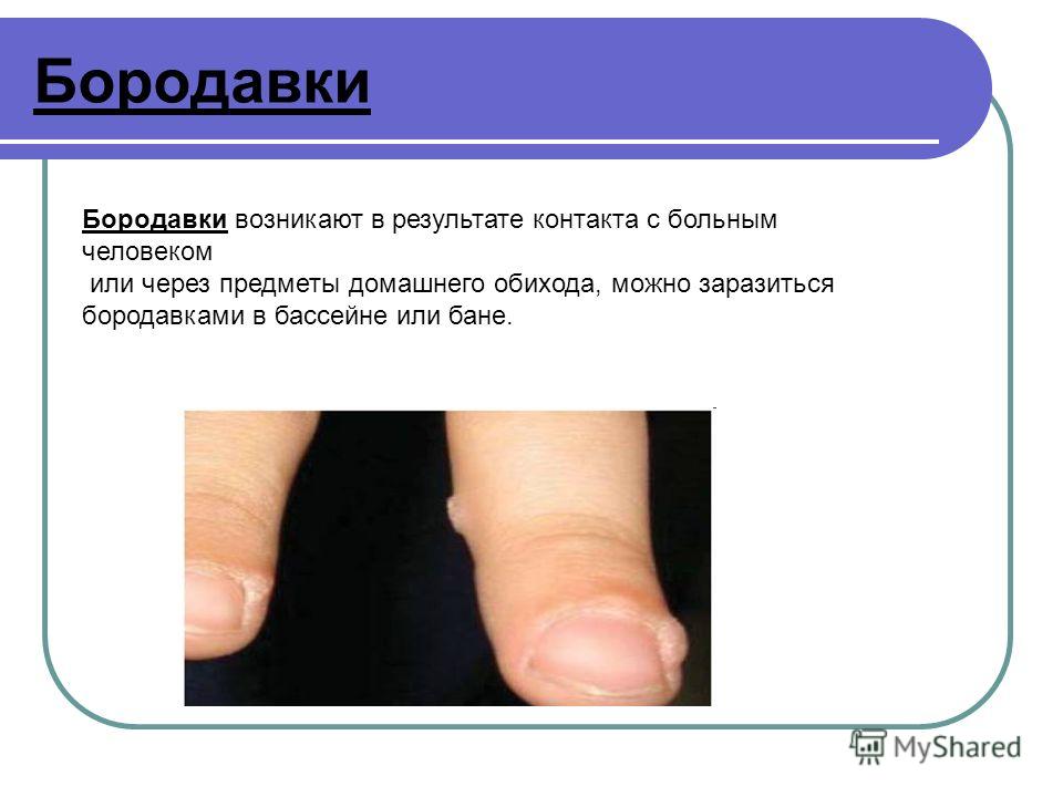 Как передаются бородавок Как передаются бородавок