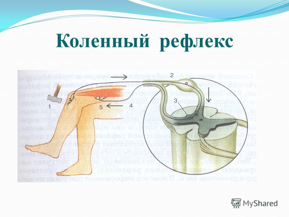 Как сделать рефлекторную Как сделать рефлекторную