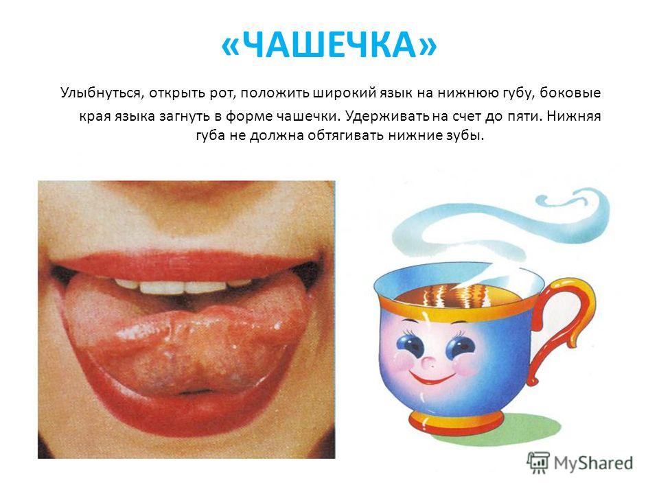 «ЧАШЕЧКА» Улыбнуться, открыть рот, положить широкий язык на нижнюю губу, боковые края языка загнуть в форме чашечки. Удерживать на счет до пяти. Нижняя губа не должна обтягивать нижние зубы.