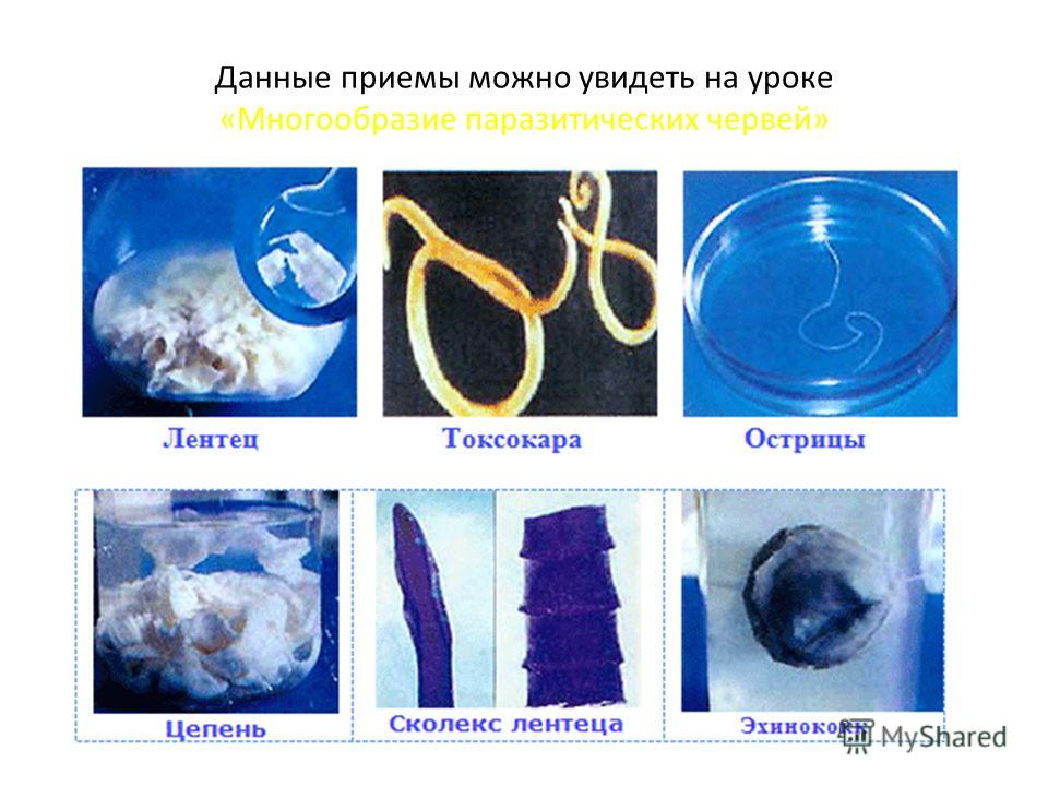 как узнать о паразитах внутри человека как узнать о паразитах внутри человека
