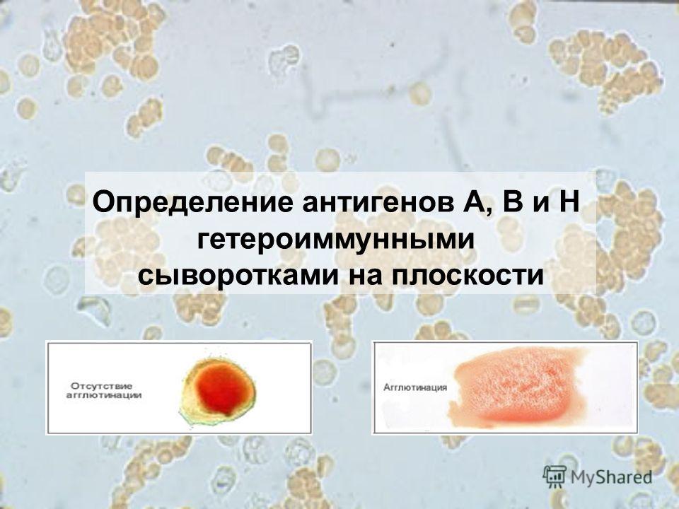 Определение антигенов А, В и Н гетероиммунными сыворотками на плоскости