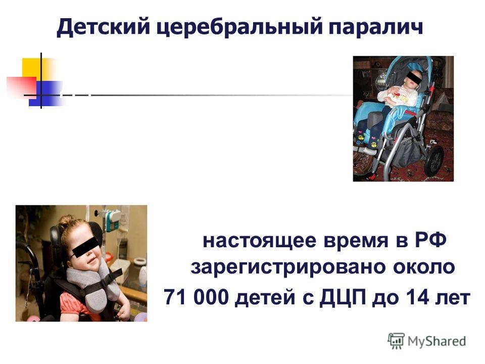 Детский церебральный паралич В настоящее время в РФ зарегистрировано около 71 000 детей с ДЦП до 14 лет ДЦП – никто не знает почему и за что???