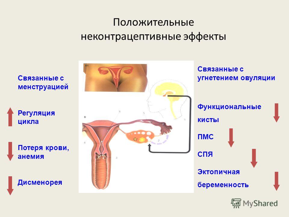 Боли связанные с менструацией Боли связанные с менструацией