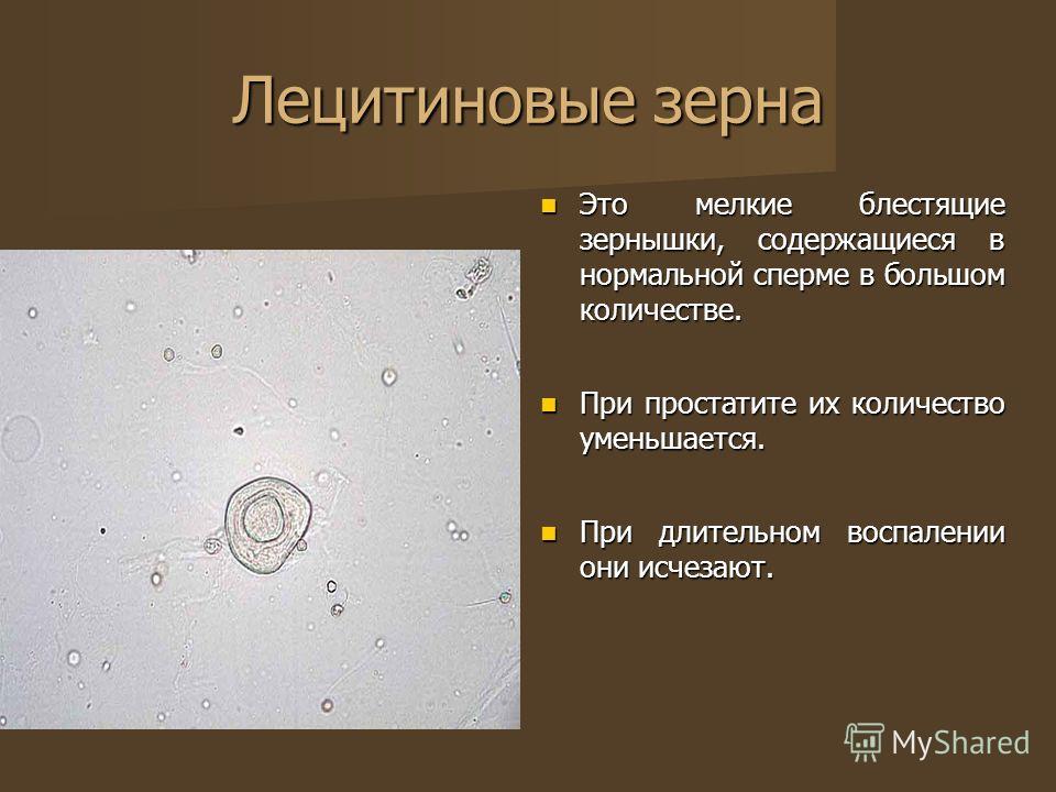 Массаж при болезни предстательной железы Массаж при болезни предстательной железы