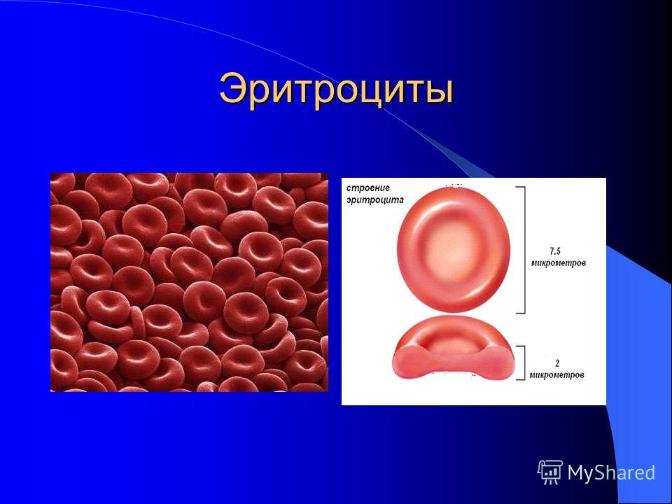 Как повысить эритроциты в крови в домашних условиях 179
