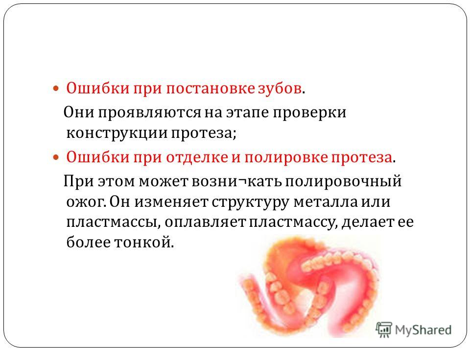 Ошибки при постановке зубов в съемном протезе Ошибки при постановке зубов в съемном протезе