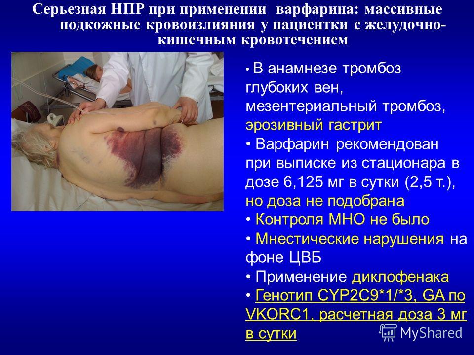 Выкройки шорт -уроки кроя и шитья Весенние поделки для детей своими руками