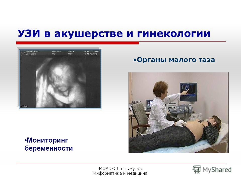 Узи в гинекологии скачать бесплатно