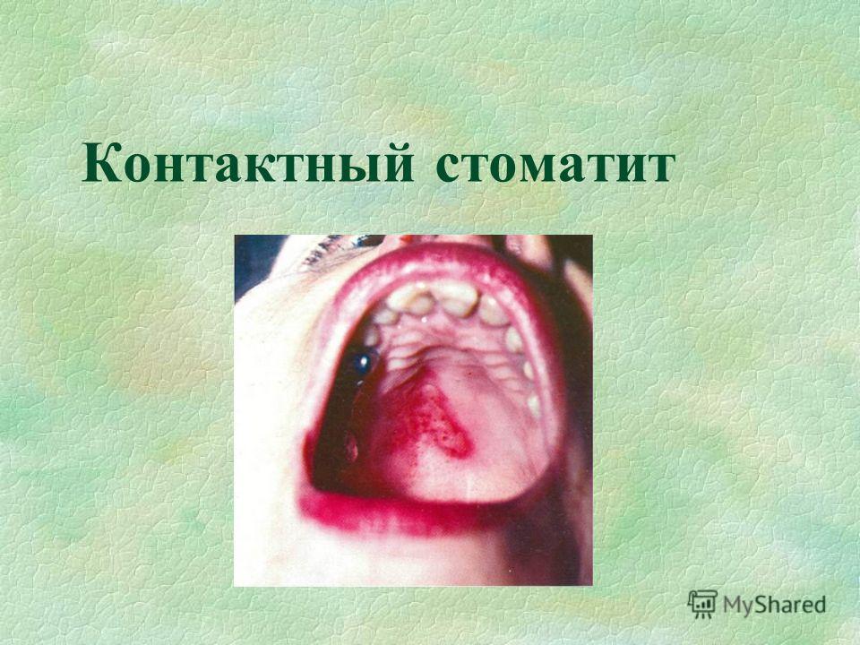 Жалобы на высыпания зуд на коже 5