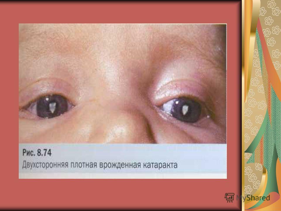 Варианты украшения свадебных бутылок своими руками - Уютка Брак между родственниками - Форумы - обсуждение, помощь, проблема