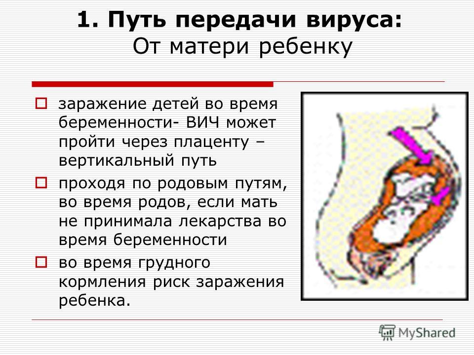 Вич у беременных профилактика 36