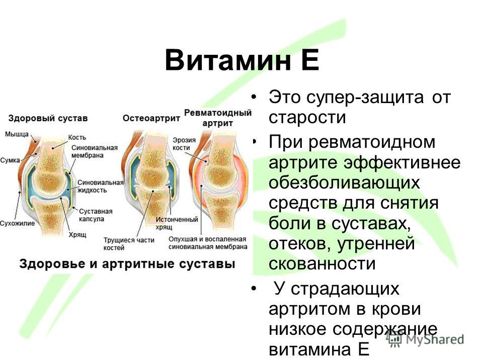 Диета При Ревматоидном Артрите