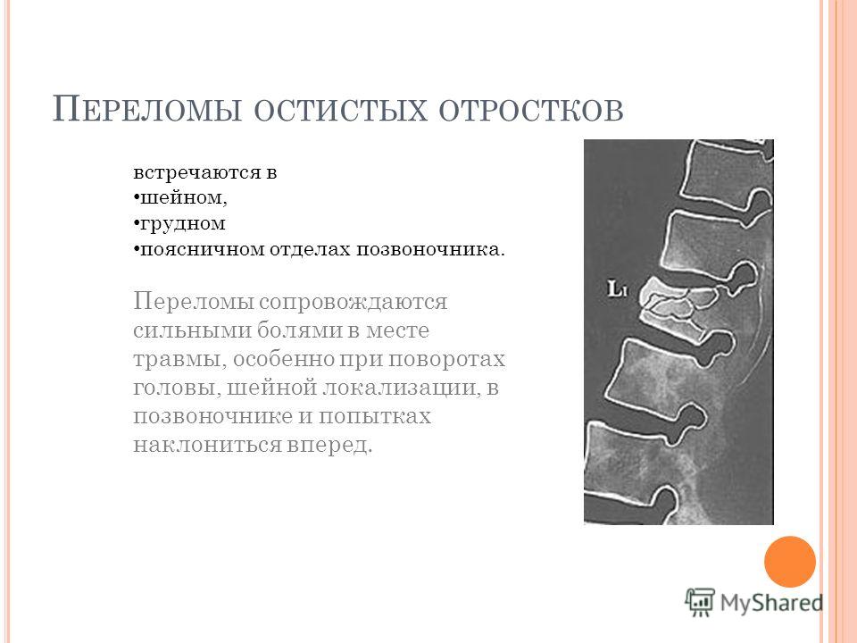 Кунцевский центр Дикуля: МРТ на Молодежной К чему снится Кость во сне по 90 сонникам! Если видишь во