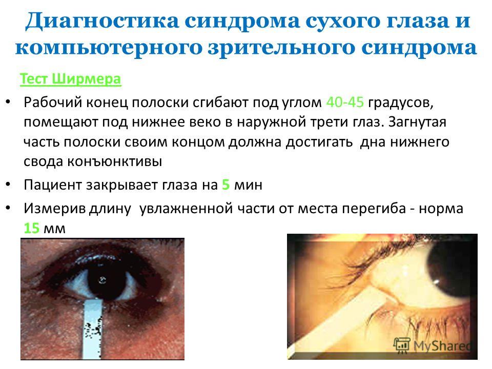 Синдромы связанные с глазами Синдромы связанные с глазами