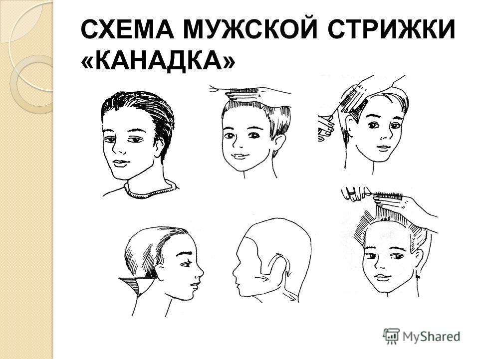 схема стрижки мужской классической