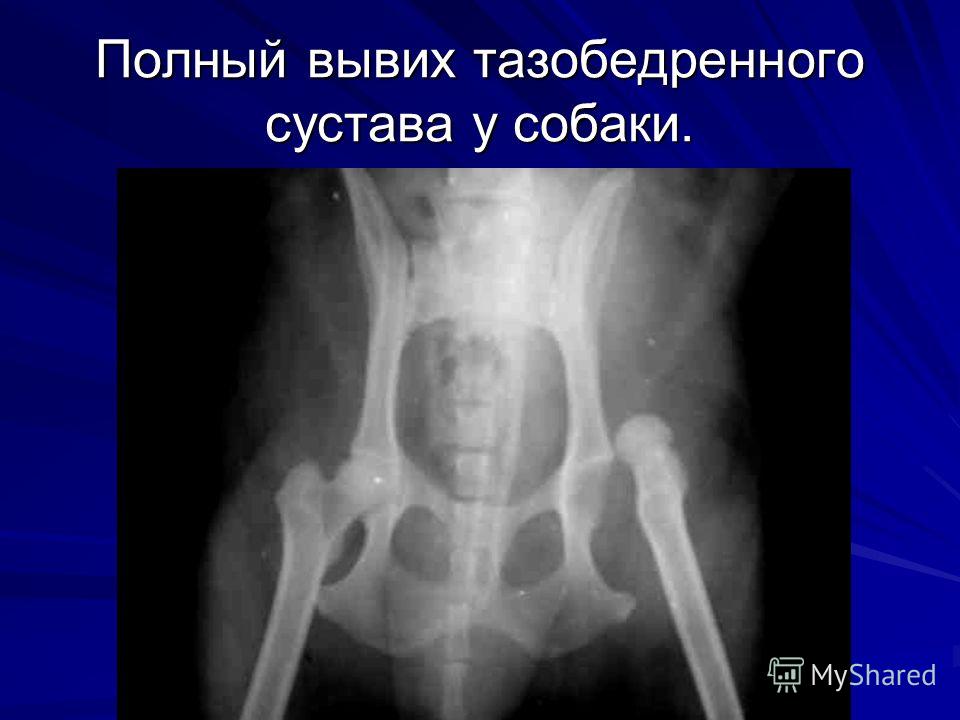 У спортсмена может быть артрит У спортсмена может быть артрит